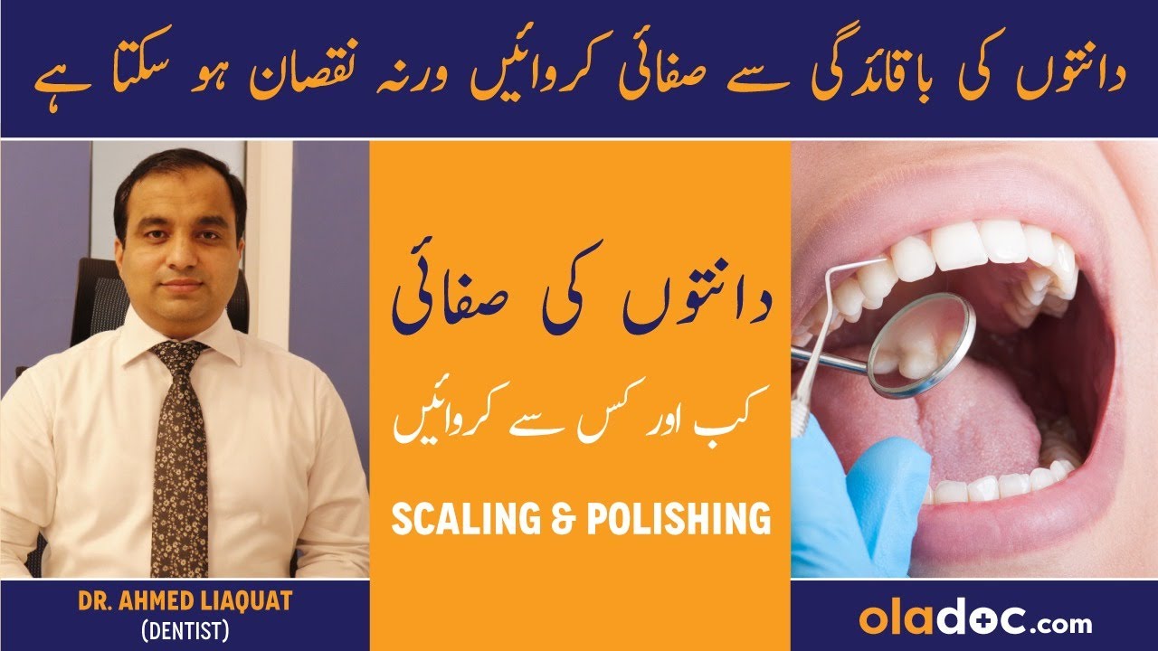 Scaling And Polishing Dental Cleaning Danto Ki Scaling Aur Safai