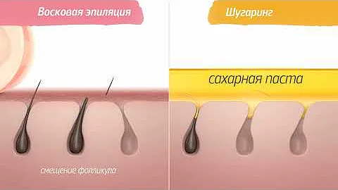 Сравнение восковой и сахарной эпиляции (шугаринга)