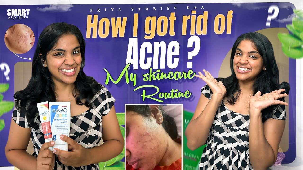 How I got rid of Acne ? || My skincare routine || USA Telugu vlogs ...