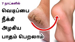 Cracked Heels Remedy - How To Treat Cracked Heels? - Beauty Tips in Tamil screenshot 4