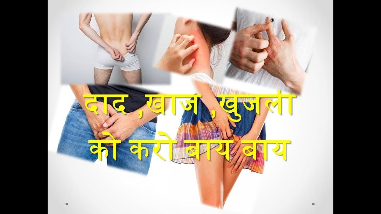 SAPAT plus Lotion सपट प्लस लोशन Uses Precaution How To Uses