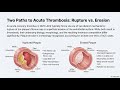 NSTEMI Non ST Elevation Myocardial Infarction Harrison Simplified