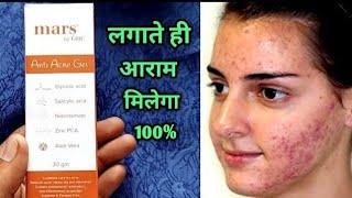 How to remove acne & darkspots | Mars By GHC | Anti Acne Gel India You Must Try