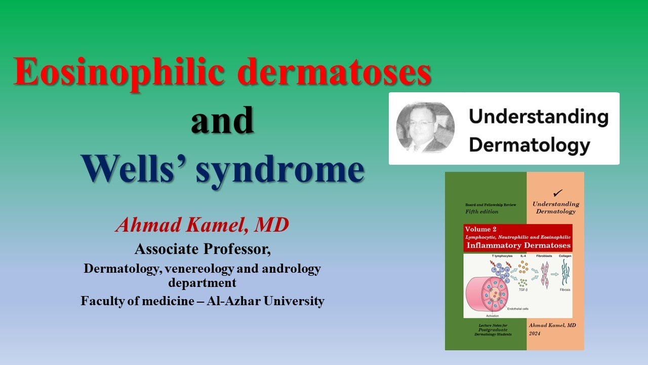 Eosinophilic Dermatoses and Wells’ Syndrome