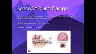 Dr. Bevan-Thomas - Spaceoar Barrigel