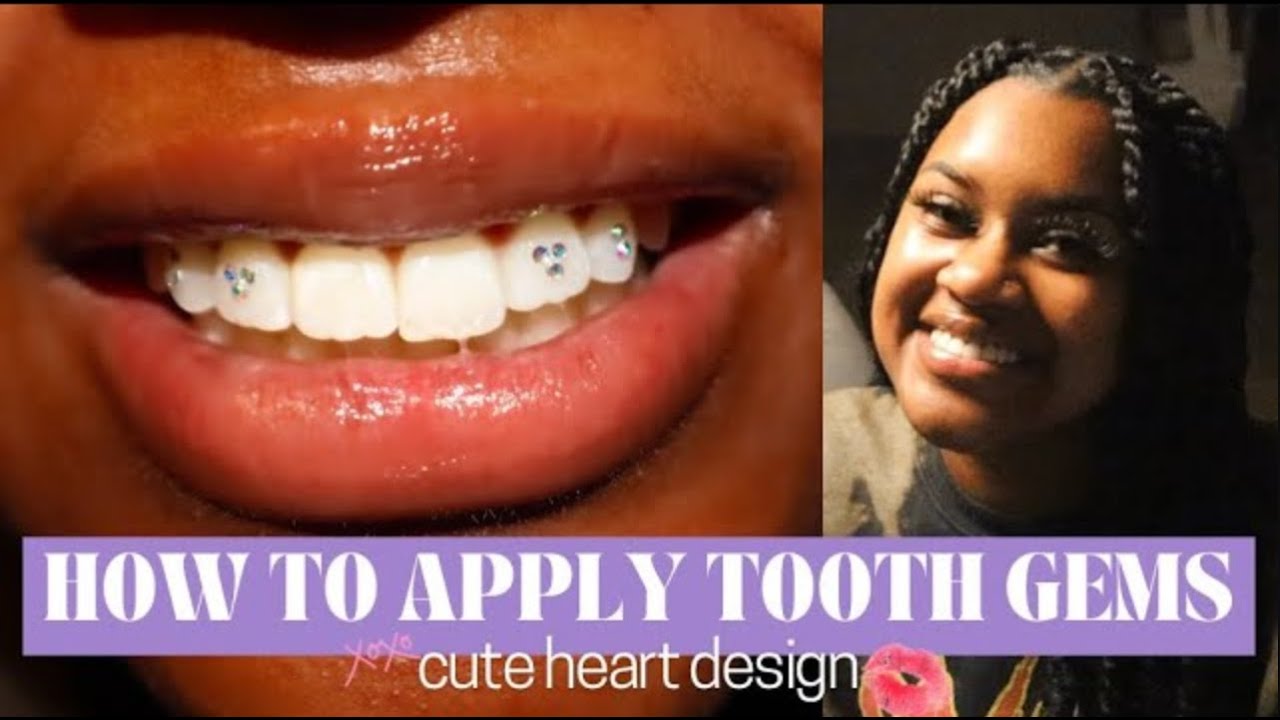 DIY Tooth Gems: ♡ cute heart design ♡
