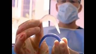 Customized Chin Implant "The Diamond Tripartite"