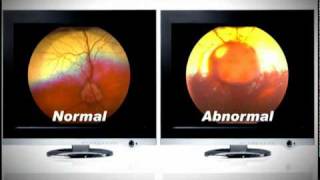 EDUCATION CLEARVIEW SYSTEM AND THE HEALTH OF YOUR PET