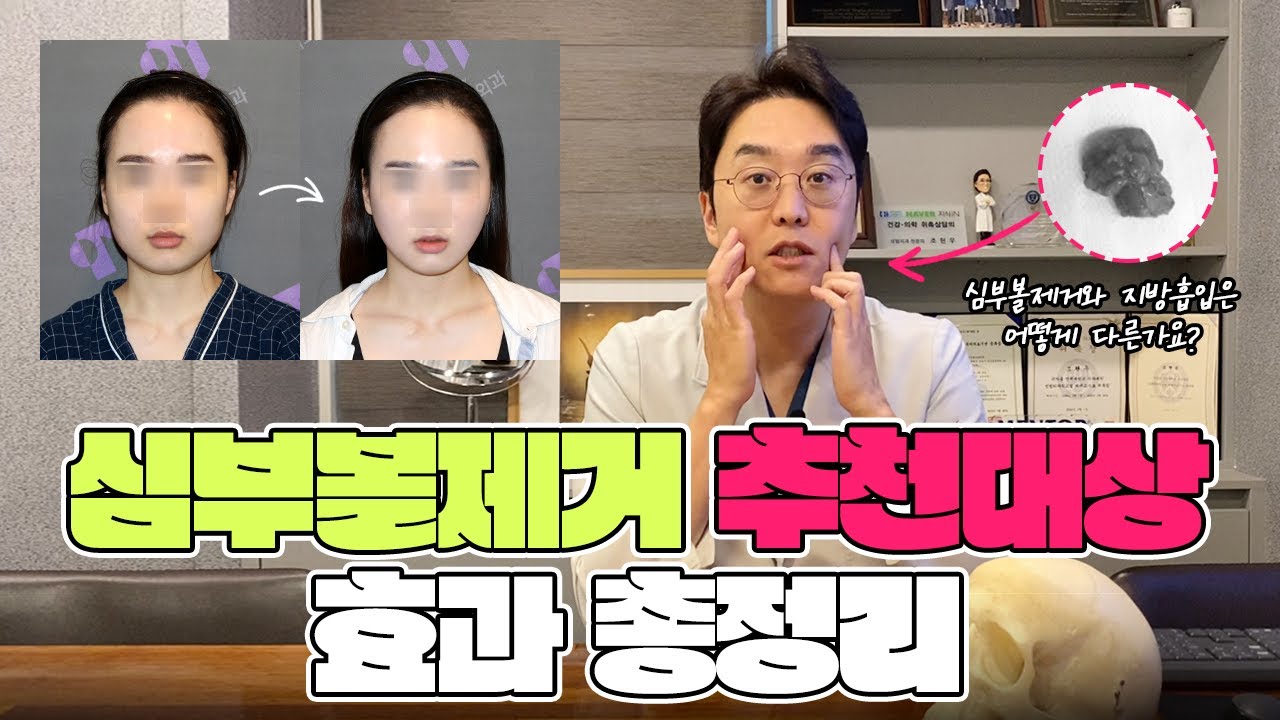 안면윤곽 심부볼지방제거 동시에 수술 가능할까?