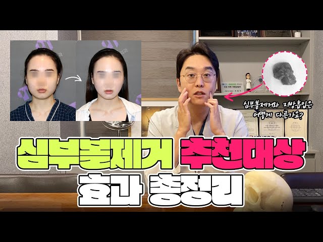 안면윤곽 심부볼지방제거 동시에 수술 가능할까?