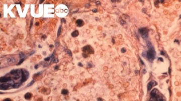 US Surgeon General issues new warning about lung cancer
