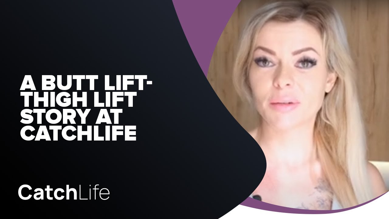 Butt Lift & Thigh Lift in Antalya, Turkey patients' stories YouTube