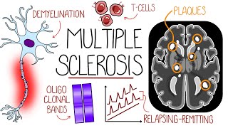 Understanding Multiple Sclerosis (Multiple Sclerosis Explained) by Rhesus Medicine 56,397 views 1 year ago 10 minutes, 10 seconds