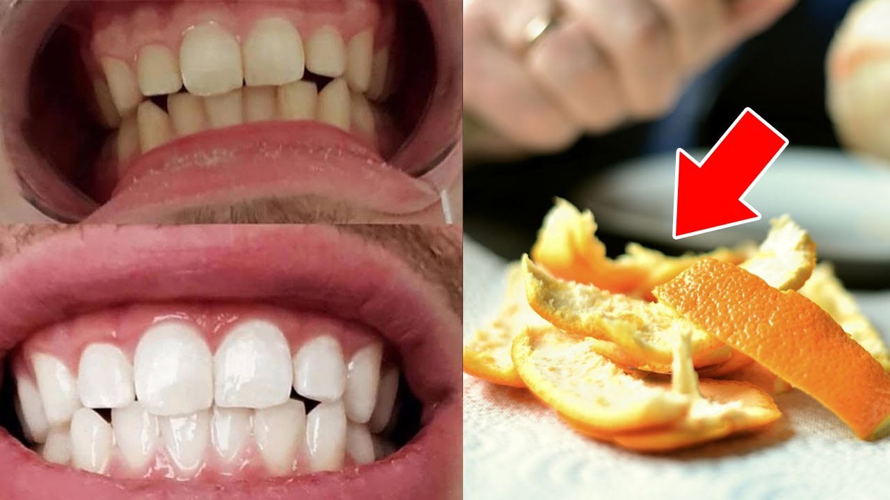 WANT TO WHITEN YOUR TEETH TRY ORANGE PEELS YouTube WANT TO WHITEN YOUR TEETH TRY ORANGE PEELS YouTube