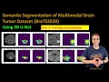 234 - Semantic Segmentation of BraTS2020 - Part 3 - Training and Prediction