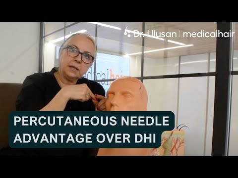 Dr. Sibel Ulusan Explains the Percutaneous Needle Advantage Over DHI!