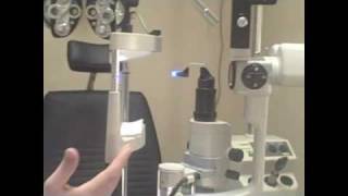 Glaucoma
