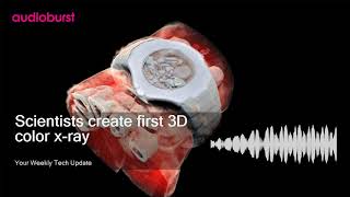 Scientists create first 3D color x-ray