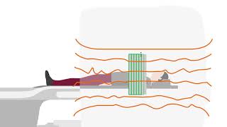 BioMatrix Tuners Slice Adjust - how it works