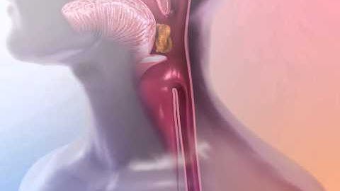 How Peristalsis Works: Learn@Visible Body