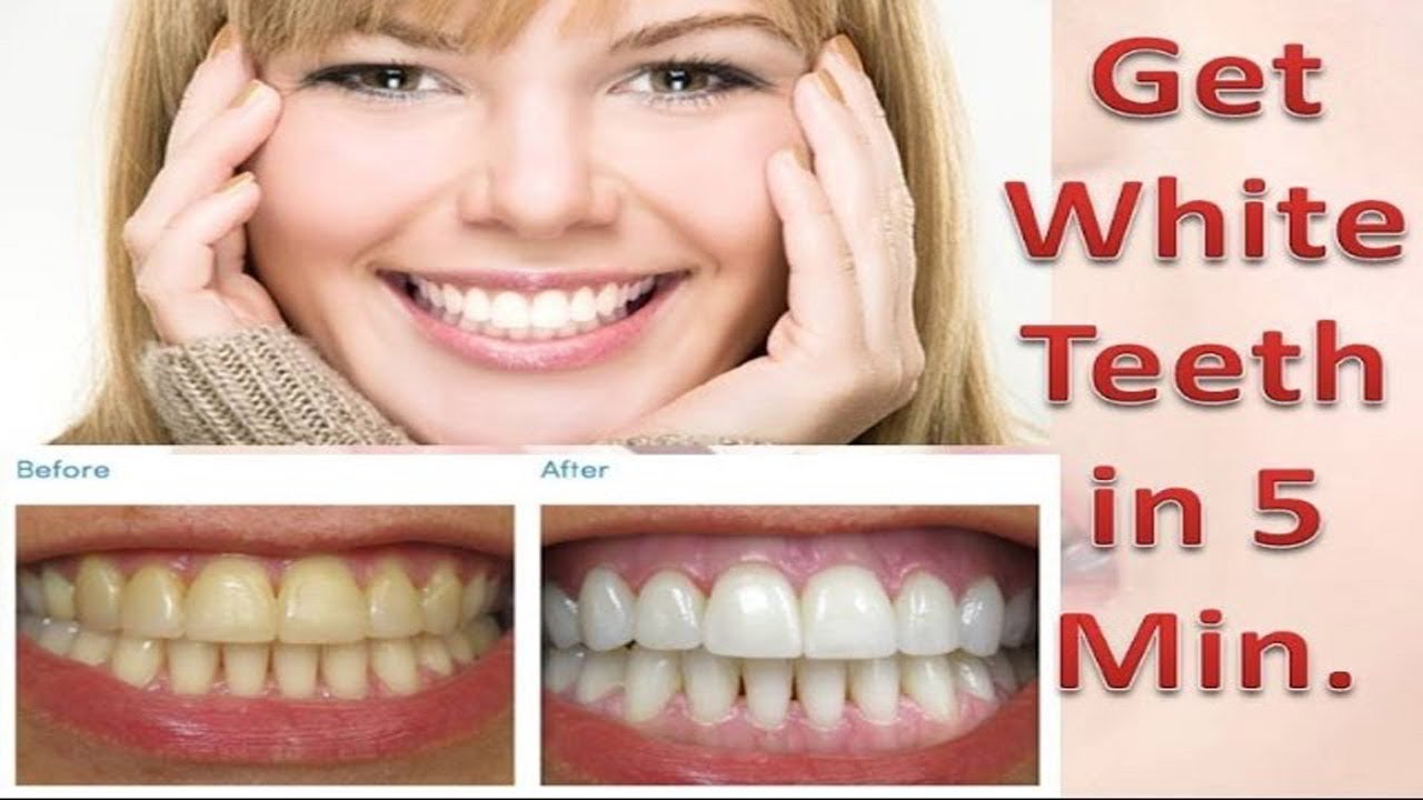 How To Whiten Your Yellow Teeth Naturally At Home 100% Working Remedy - YouTube