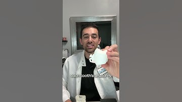 LightForce Braces Simplified