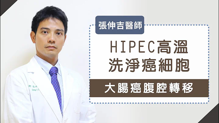 《腹腔溫熱化療》大腸癌腹腔轉移！HIPEC高溫對抗癌細胞-張伸吉醫師 - 天天要聞