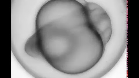 Long-term imaging of zebrafish w light sheet microscopy 4