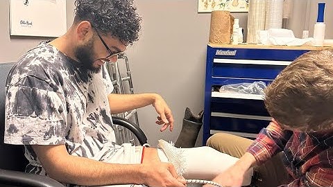 Össur direct-fit socket full procedure