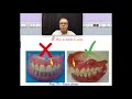 os 5 maiores erros de uma dentadura