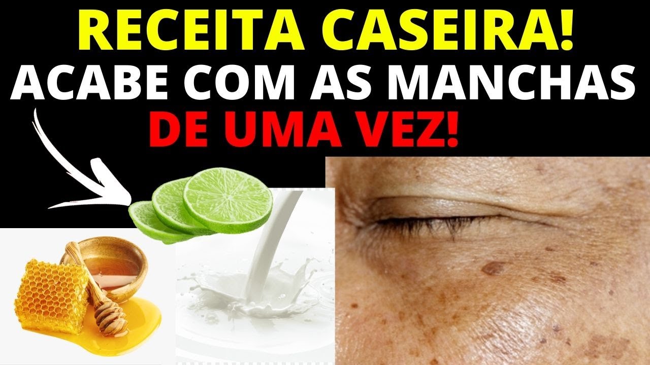 Como Tirar MANCHAS DO ROSTO, RECEITA CASEIRA Com Ingredientes MUITO ...