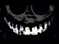 Doors Light Funk Dj Vttt77 Super Slowed 