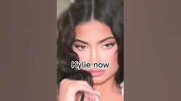 Kylie in the 2000’s vs now