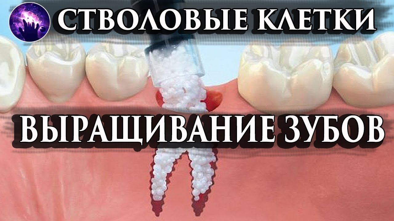 СТВОЛОВЫЕ КЛЕТКИ. ВЫРАЩИВАНИЕ ЗУБОВ. Регрессивный гипноз. Лаборатория ...