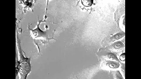 Migrating neuronal cells