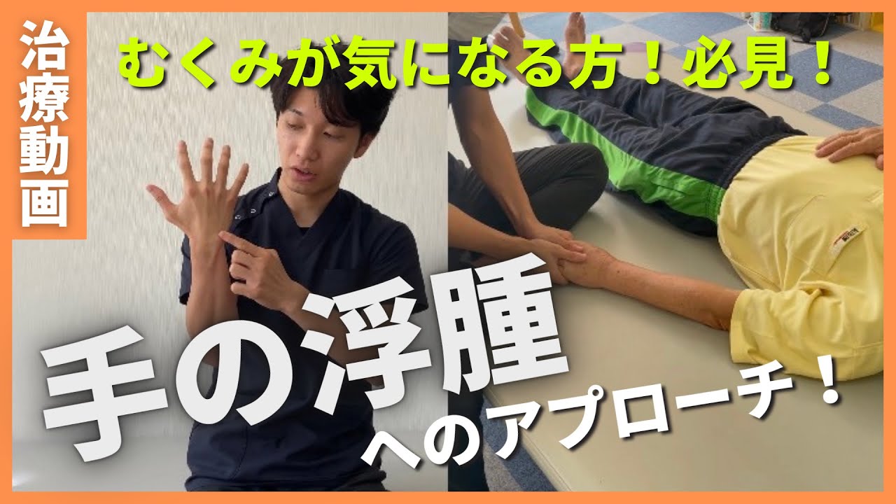 【片麻痺リハビリ治療動画】手の浮腫（むくみ）を改善する方法をご紹介しますー沖縄脳卒中リハビリセンターホコトレー