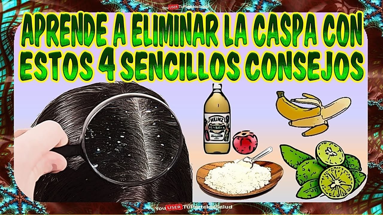 CASPA Aprende a Eliminarlo con Estos 4 Sencillos Remedios- Como ...