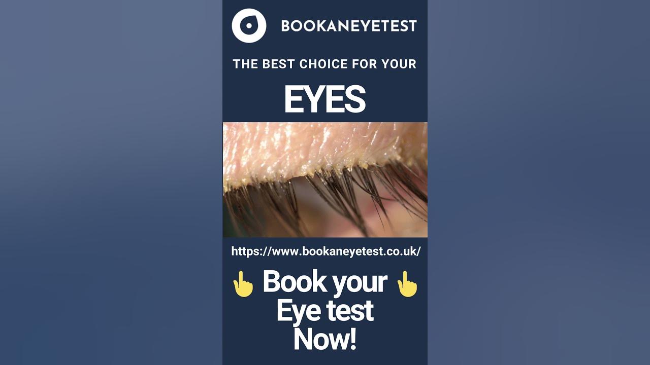 Crust on eyelids why do my eyes feel like they have a crust book