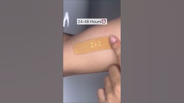 How to patch test product?