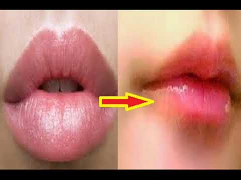 Yang Punya Bibir Tebal Ini 4 Solusi Untuk Membuatnya Tipis M3nggoda