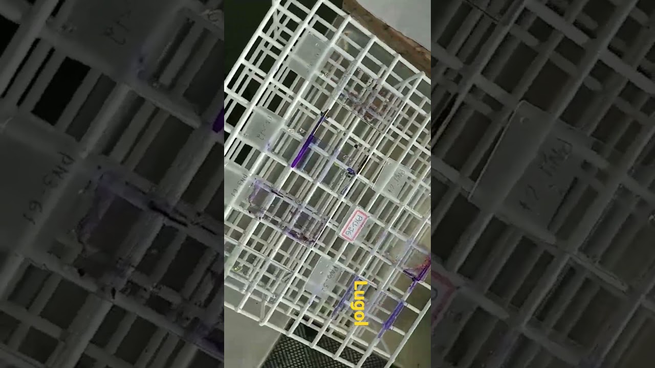 how-to-do-gram-staining-2022-gram-staining-technique-colora-o-de