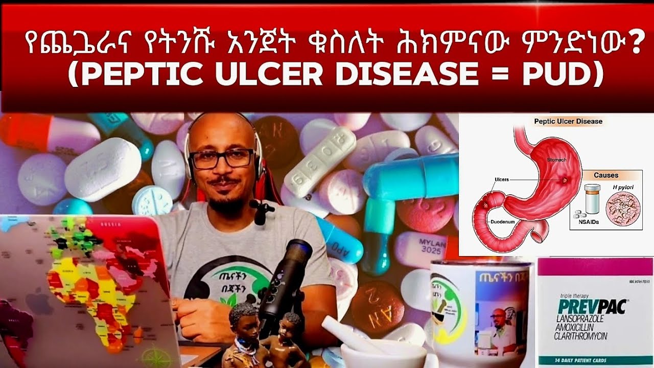 Episode 21. የጨጔራና የአንጀት ቁስለት በሽታ ሕክምናው ምንድነው? @drSammyTenachin
