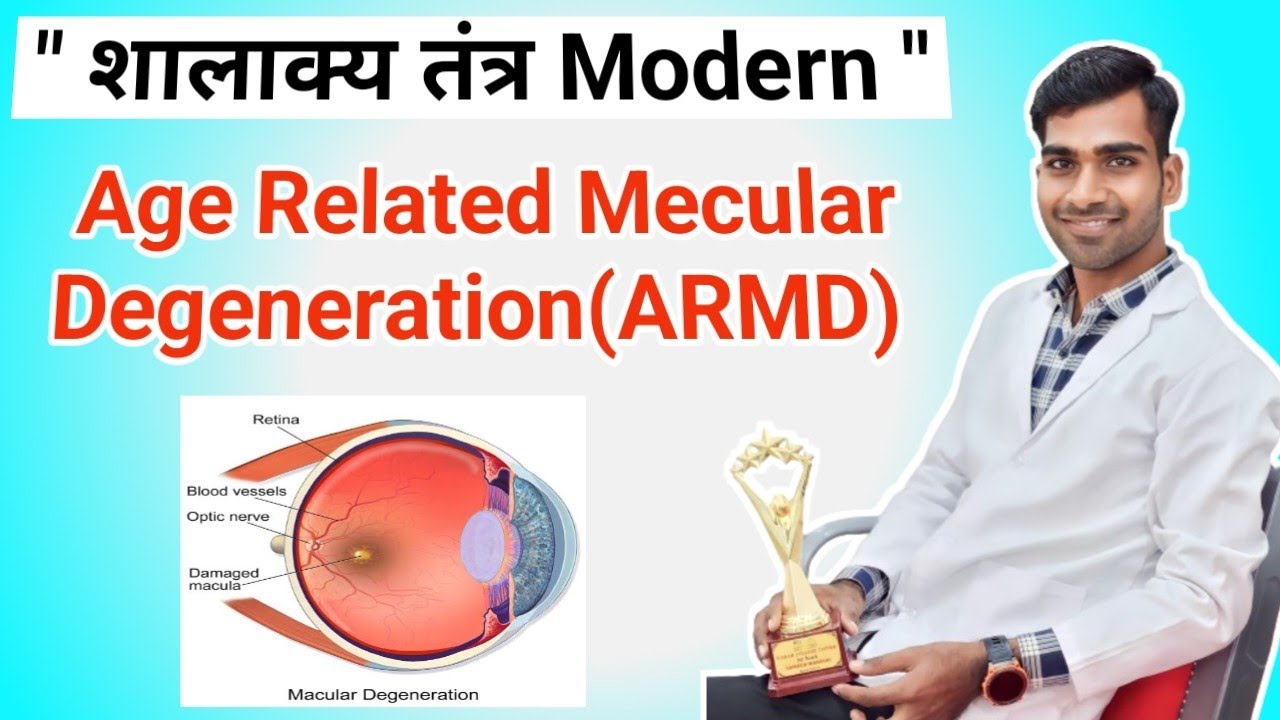 ARMD Eye Disease In Hindi | ARMD Opthalmology | Shalakya Tantra | BAMS |  Easy Simple Tricks