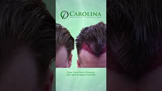 Carolina Hair Surgery performs FUE Hair Transplant Exclusively
