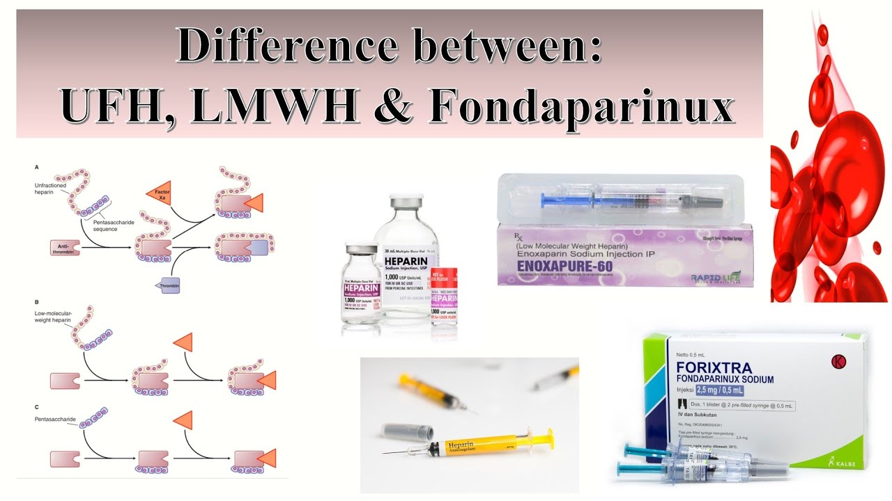 Difference between UFH, LMWH and Fondaparinux - YouTube