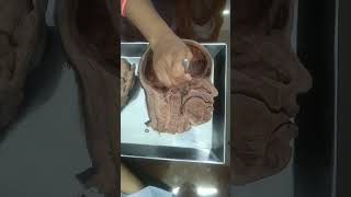 Hemisection of the head and neck in gross anatomy