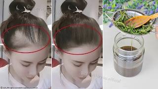 видео: Волосы растут как сумасшедшие и не выпадают! Это самый мощный рецепт! Самый сильный ингредиент картинка: Волосы растут как сумасшедшие и не выпадают! Это самый мощный рецепт! Самый сильный ингредиент