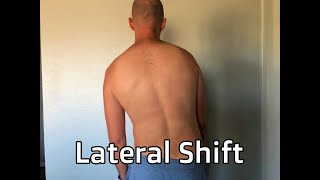 Lateral Shift
