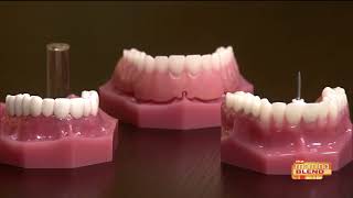 Benefits Of Mini Dental Implants