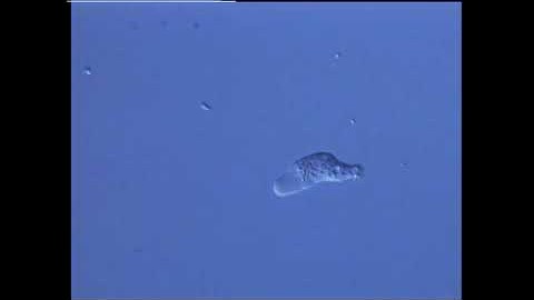 Amoeboid movement